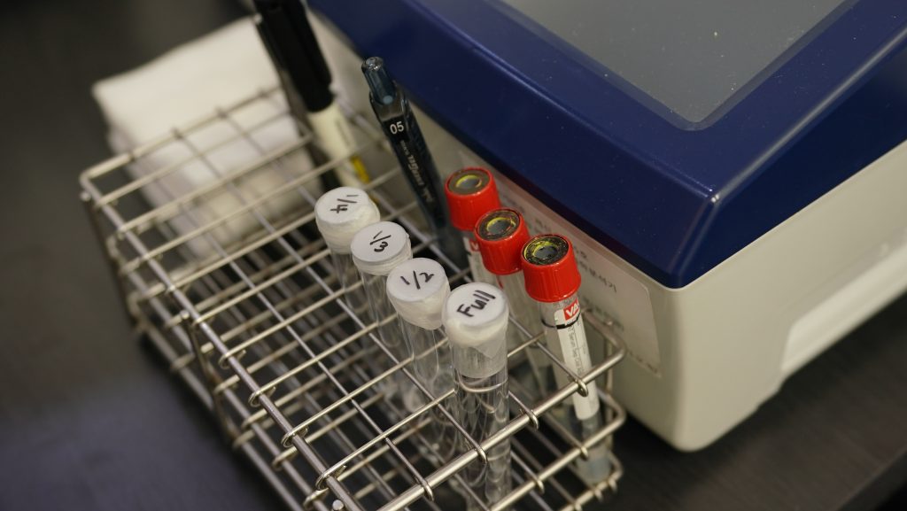 편도결석 냄새 안 날 수도 있는 이유